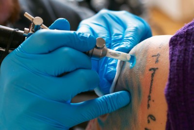 Tattoo Injuries